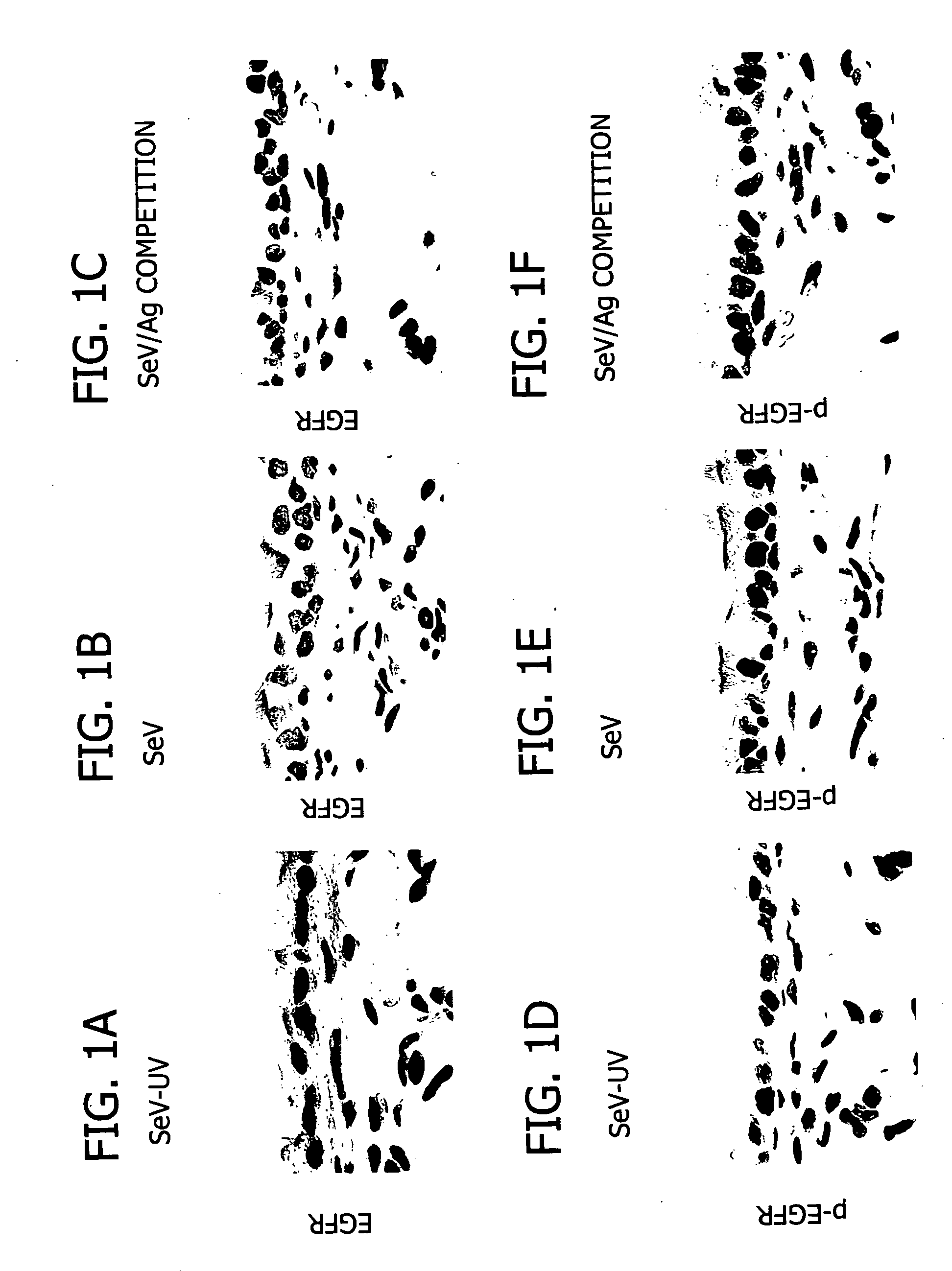 Compositions and methods for treatment of airway hypersecretion