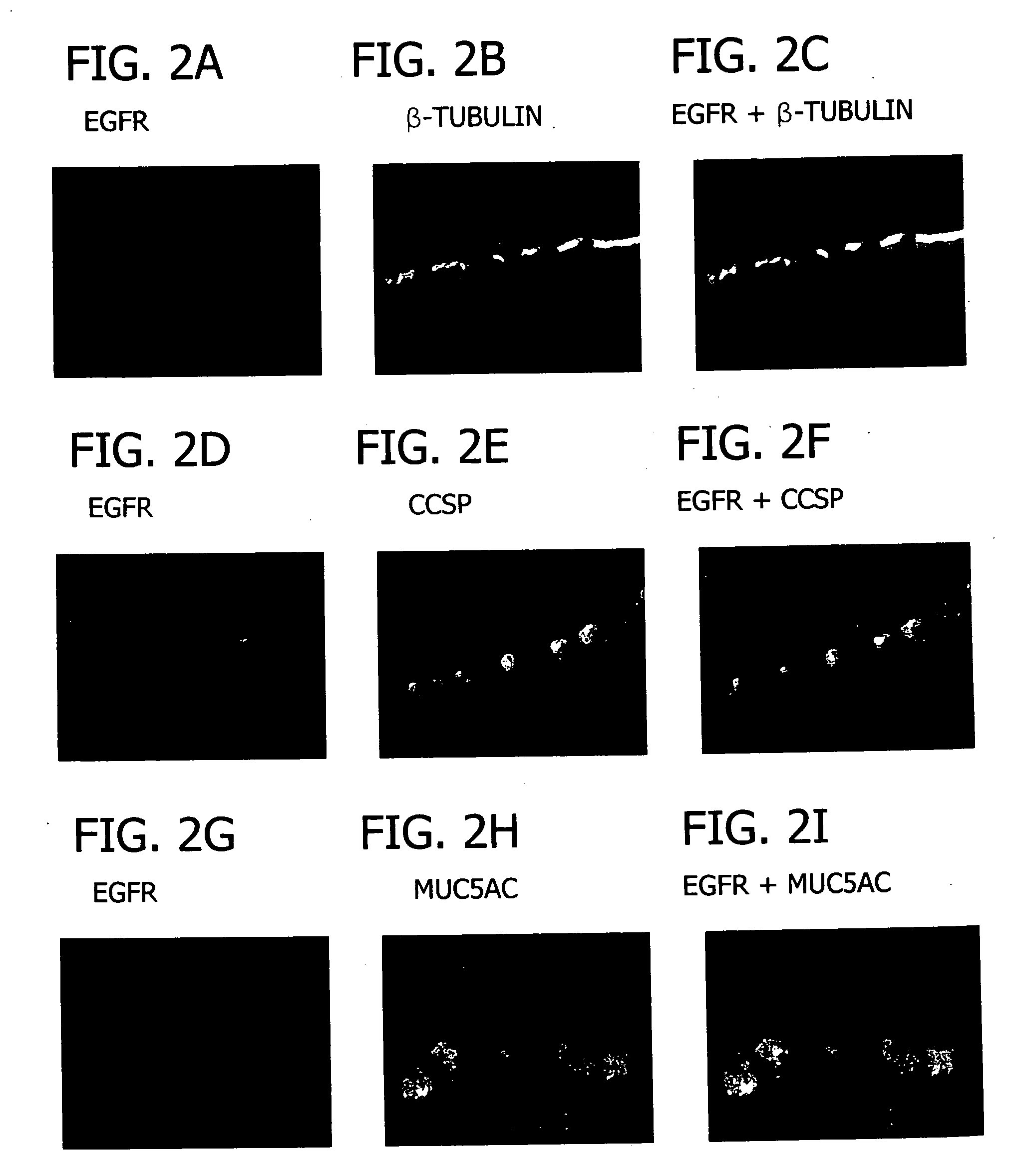 Compositions and methods for treatment of airway hypersecretion
