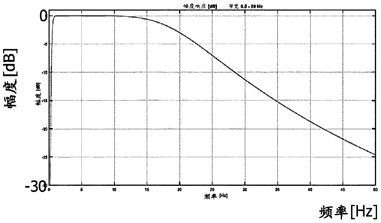 Method for operating a blood pressure measuring device and arrangement for measuring the pressure in a blood vessel