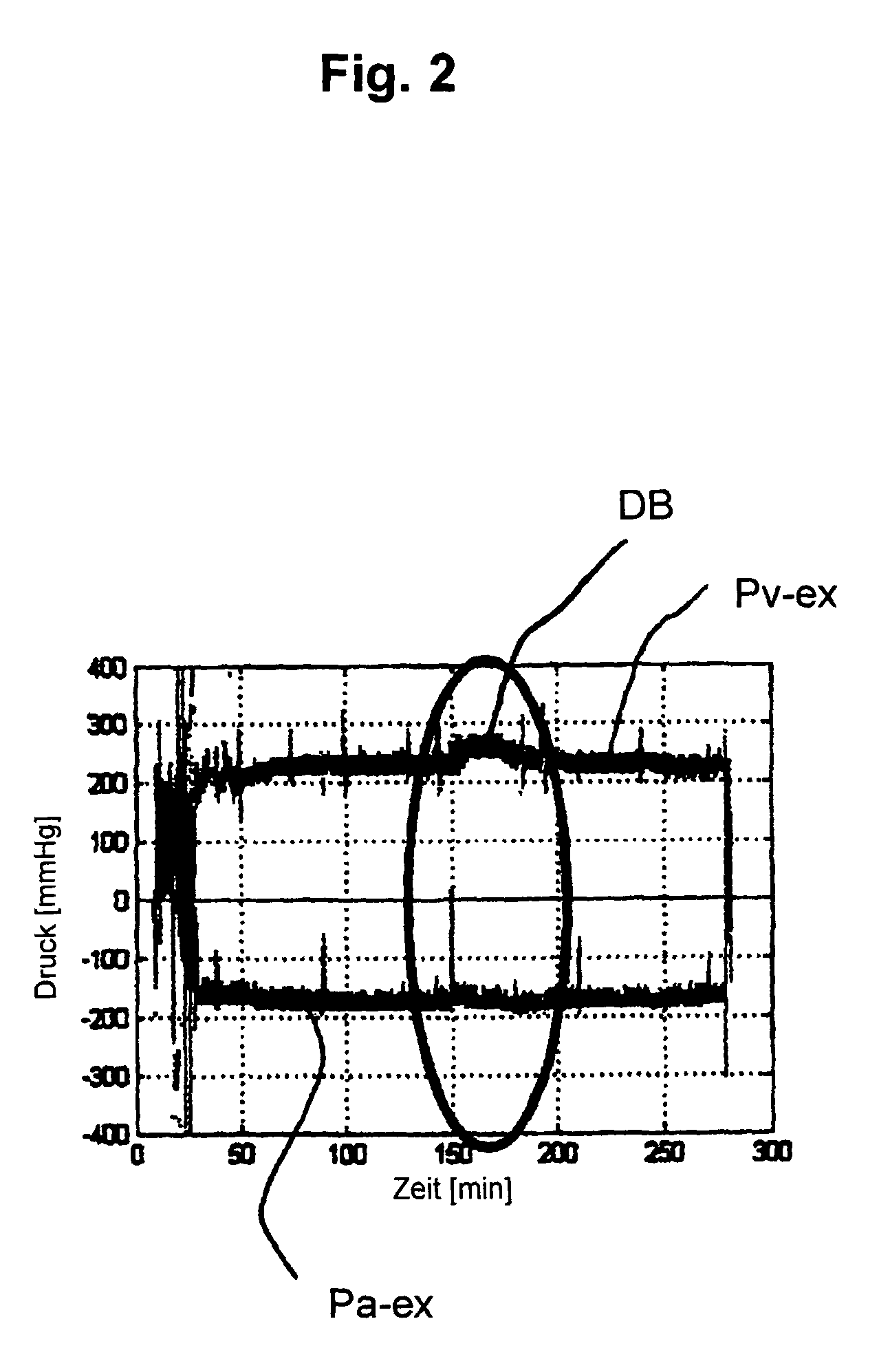 Method of operating a blood treatment apparatus, and blood volume monitor and blood treatment apparatus for implementing the method