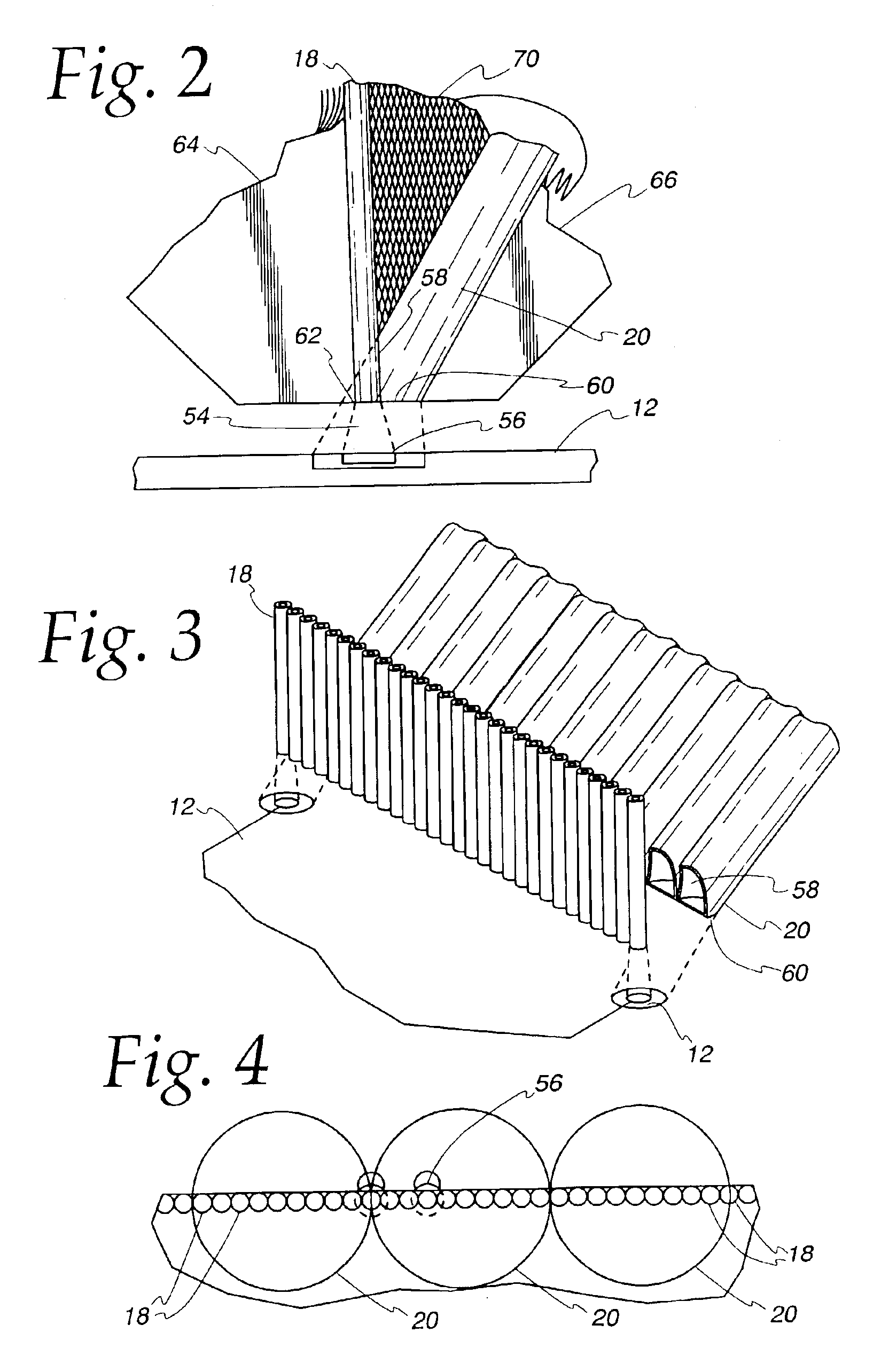 Method and apparatus for radiographic imaging