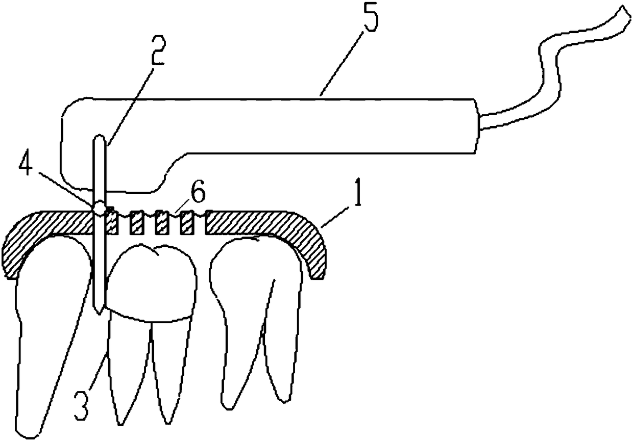 Efficient method for manufacturing tooth preparation guide plates