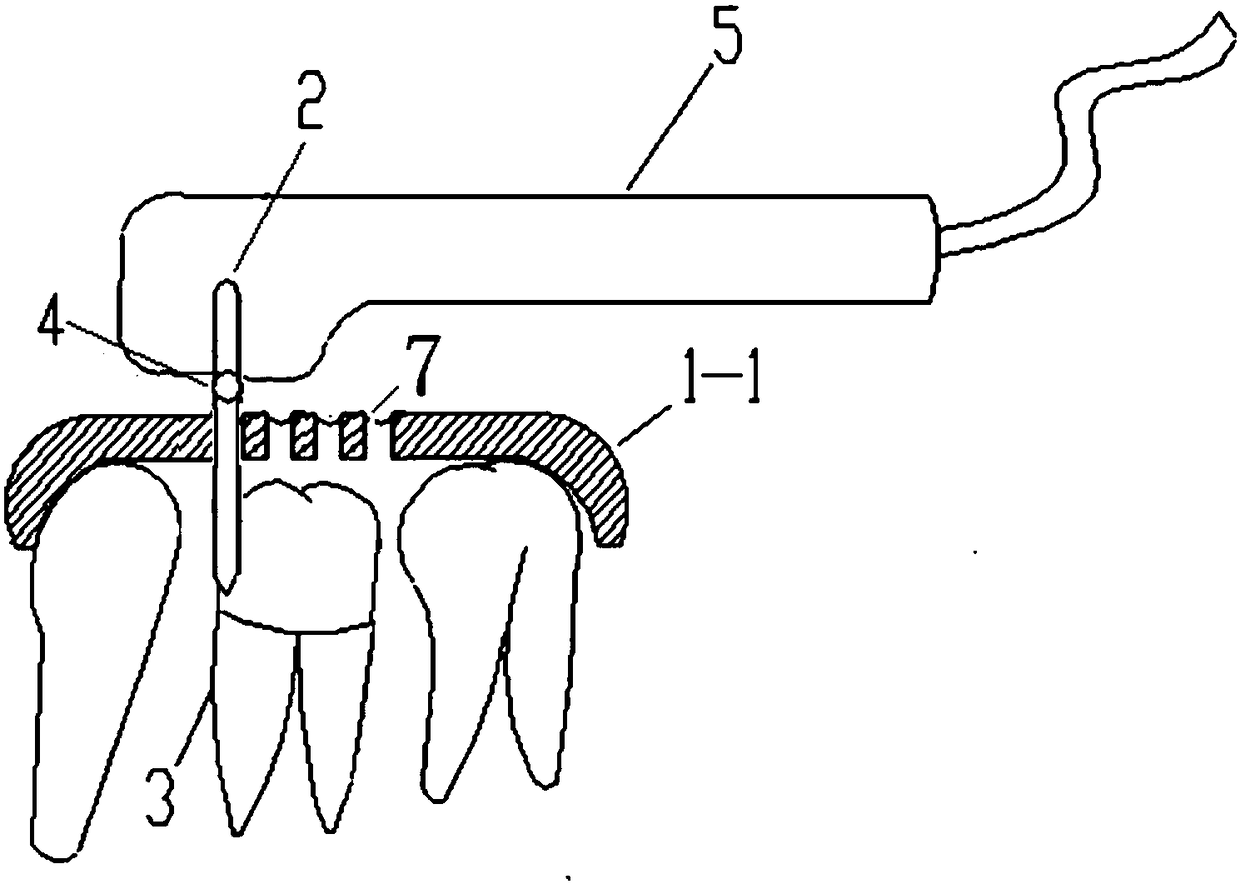 Efficient method for manufacturing tooth preparation guide plates