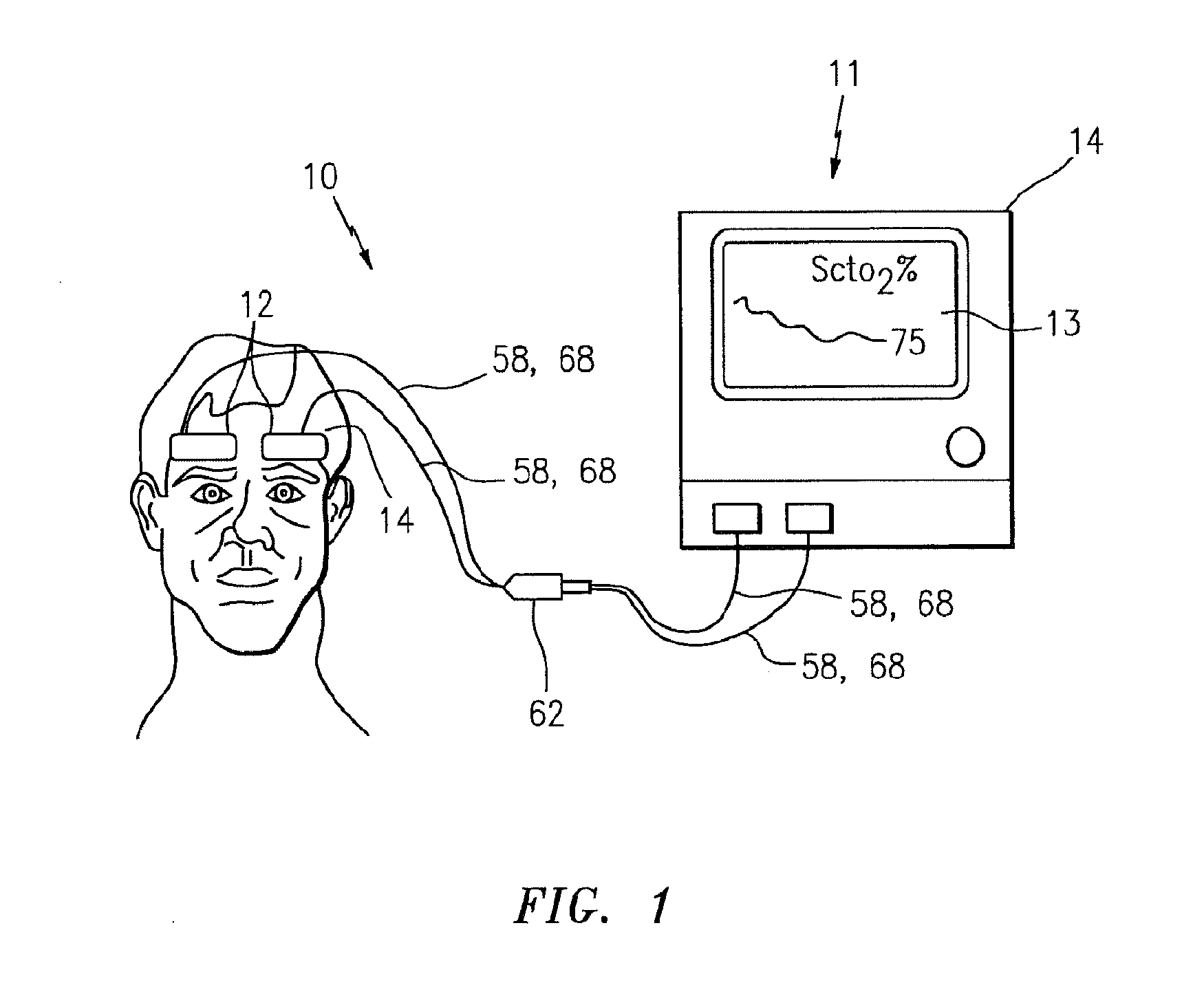 Nirs sensor assembly including electrically conductive and optically transparent EMI shielding