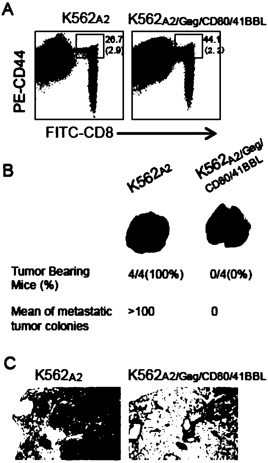 T cell vaccine constructed by secretory component of gene engineering-based aAPC (artificial Antigen Presenting Cell) as well as preparation method and application thereof