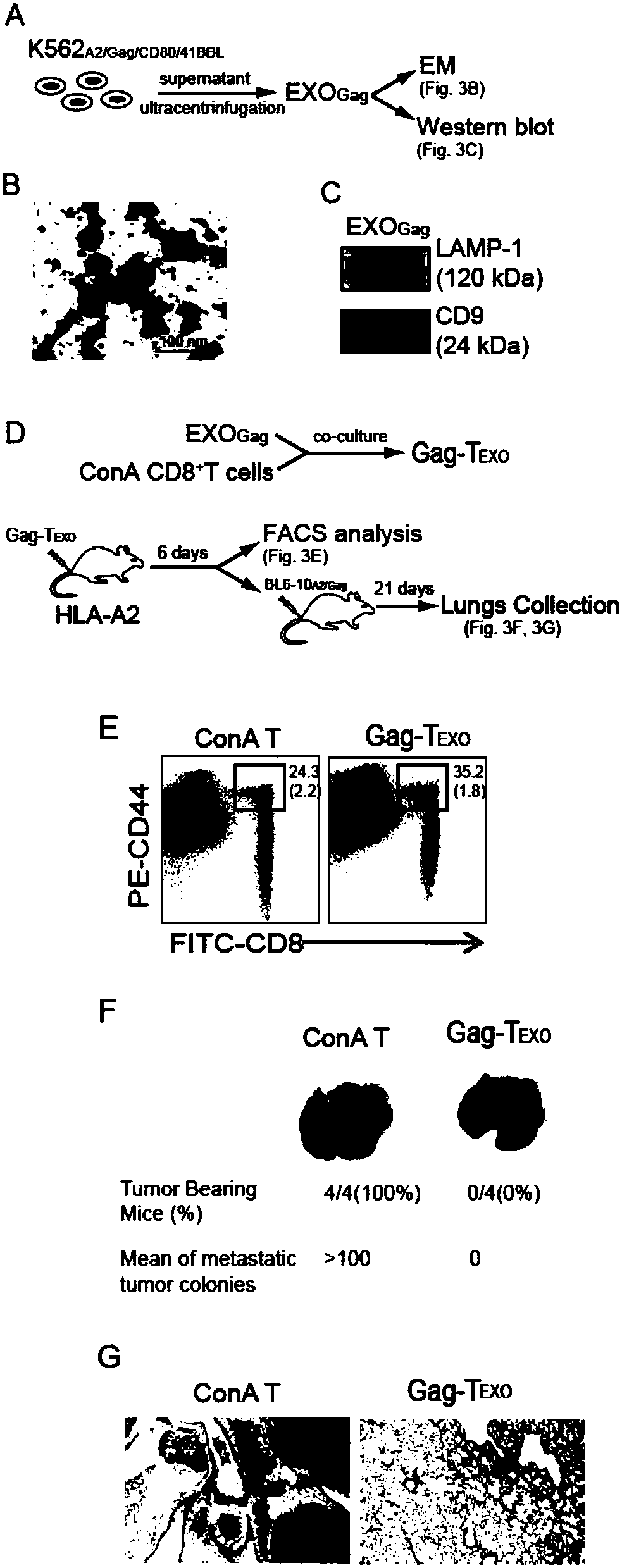 T cell vaccine constructed by secretory component of gene engineering-based aAPC (artificial Antigen Presenting Cell) as well as preparation method and application thereof