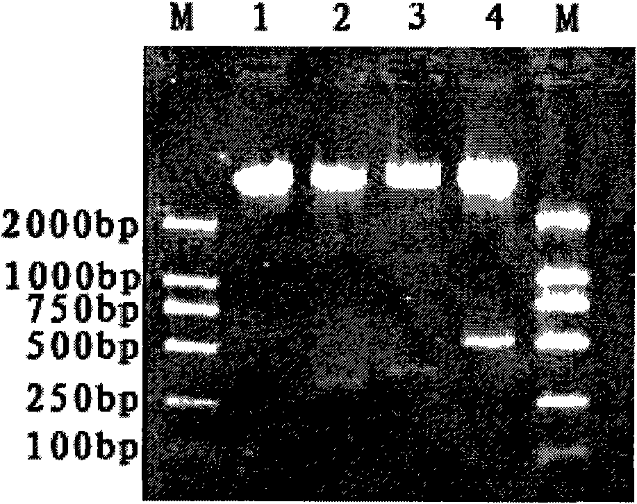 Schistosoma japonicum recombinant multi-epitope antigens, method for expressing and purifying same and application thereof