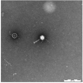 Phage vb_yen_x1 and its application in the prevention and treatment of Yersinia pestis infection