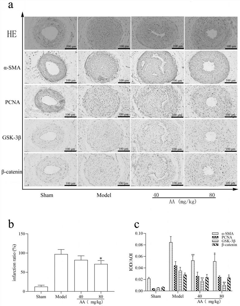 Total saponins ofRadix araliae armatae and application thereof in preparation of medicine for treating restenosis after vascular injury