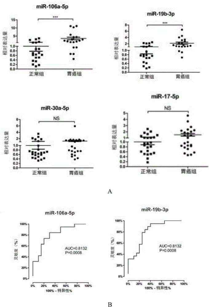 Serum exosome miRNA biological marker and kit for early diagnosis of gastric cancer