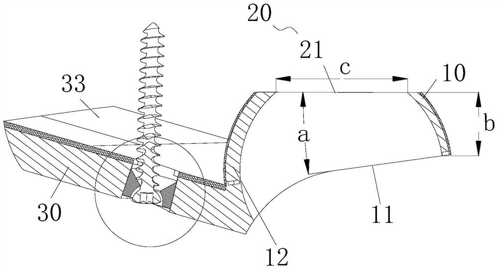 Acetabular prosthesis