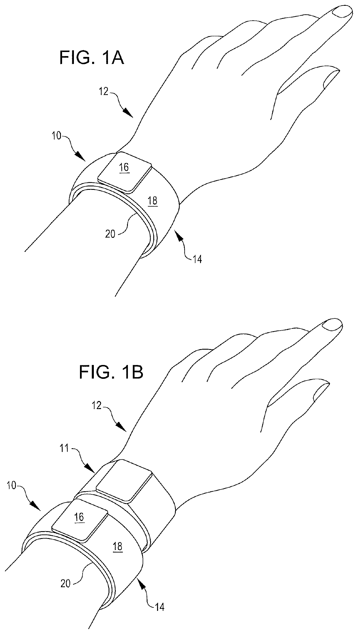 Inflatable Cuffs With Controllable Extensibility