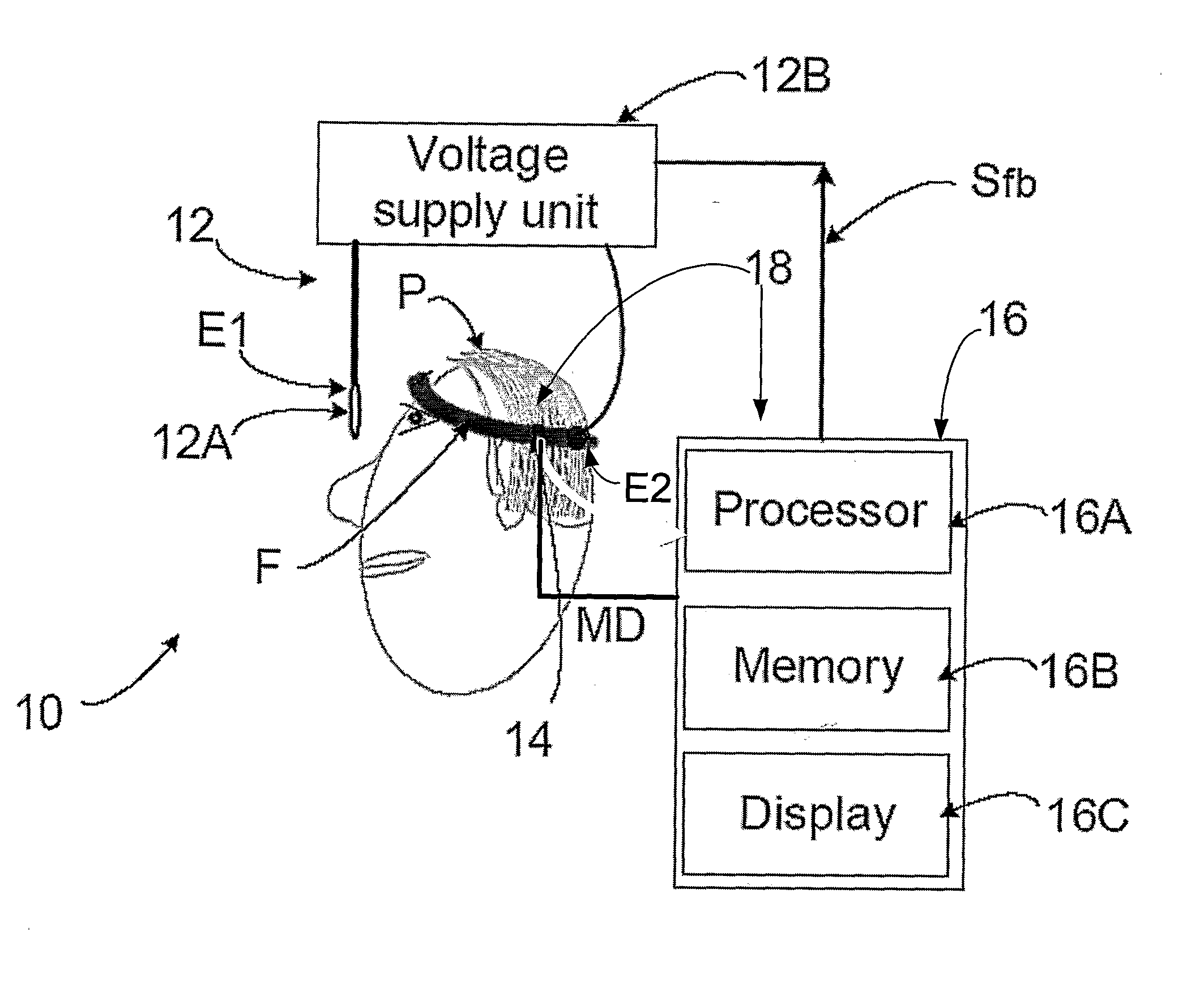 Device and Method for Pupil Size Modulation
