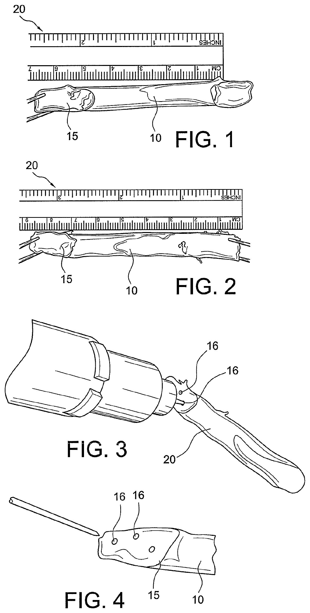 Bone tendon constructs and methods of tissue fixation