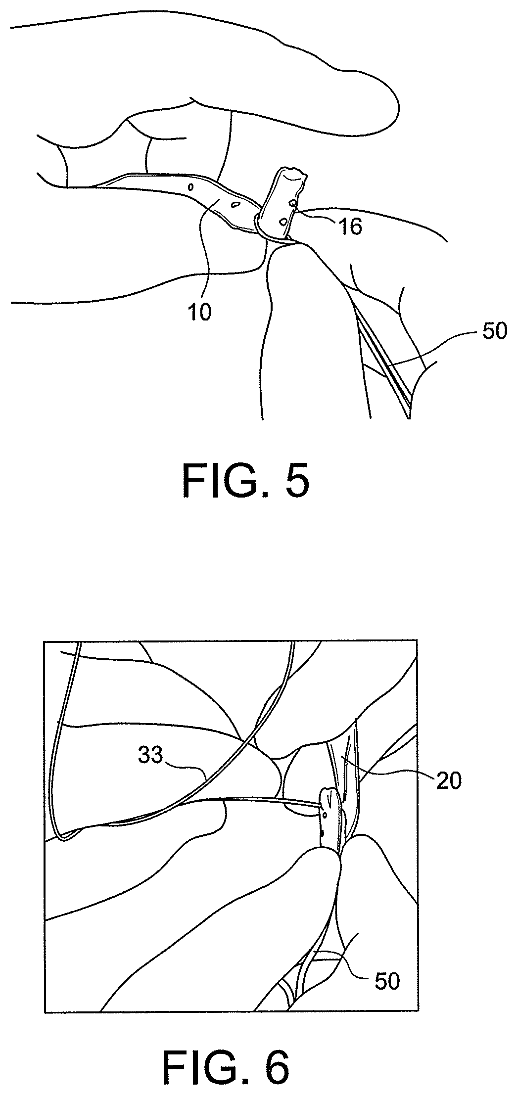 Bone tendon constructs and methods of tissue fixation