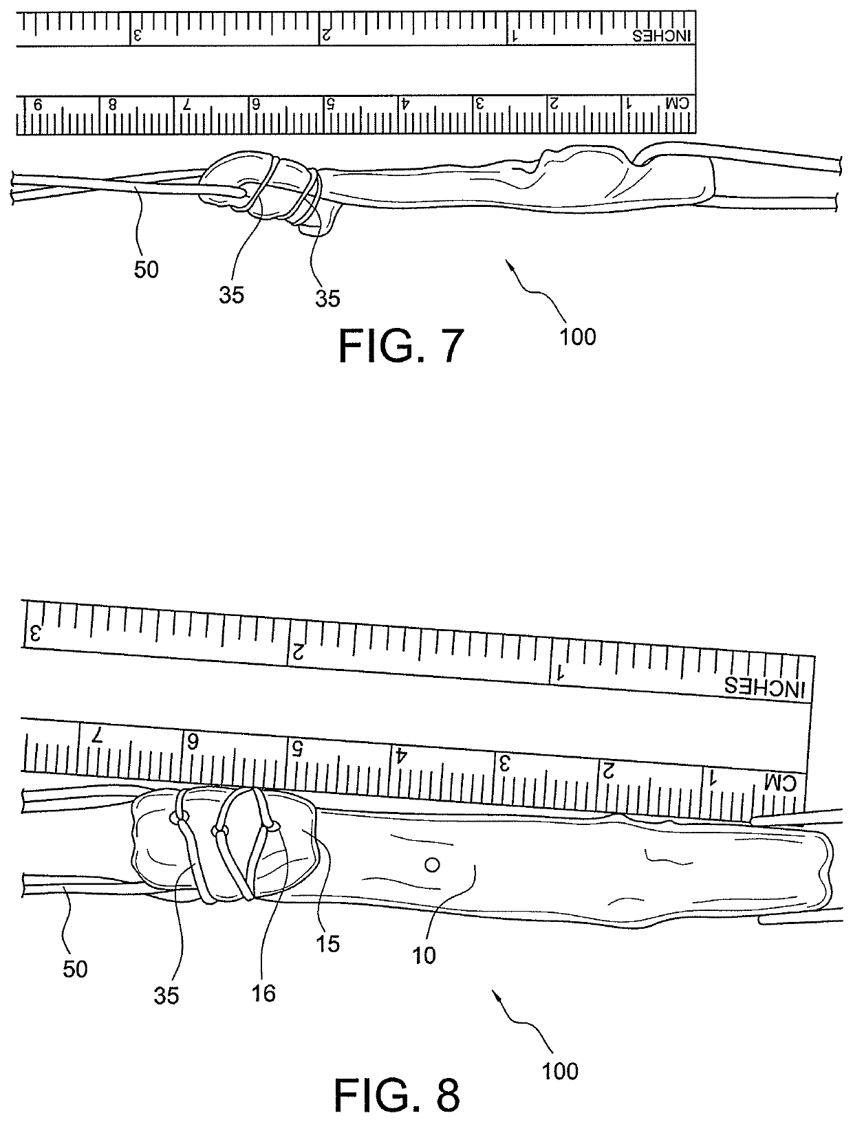 Bone tendon constructs and methods of tissue fixation