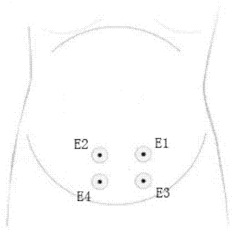 Delivery starting forecasting device based on uterine electromyography and method for extracting characteristic parameter