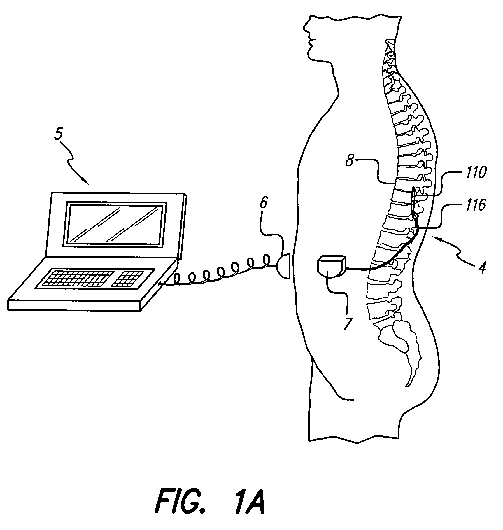Switched-matrix output for multi-channel implantable stimulator