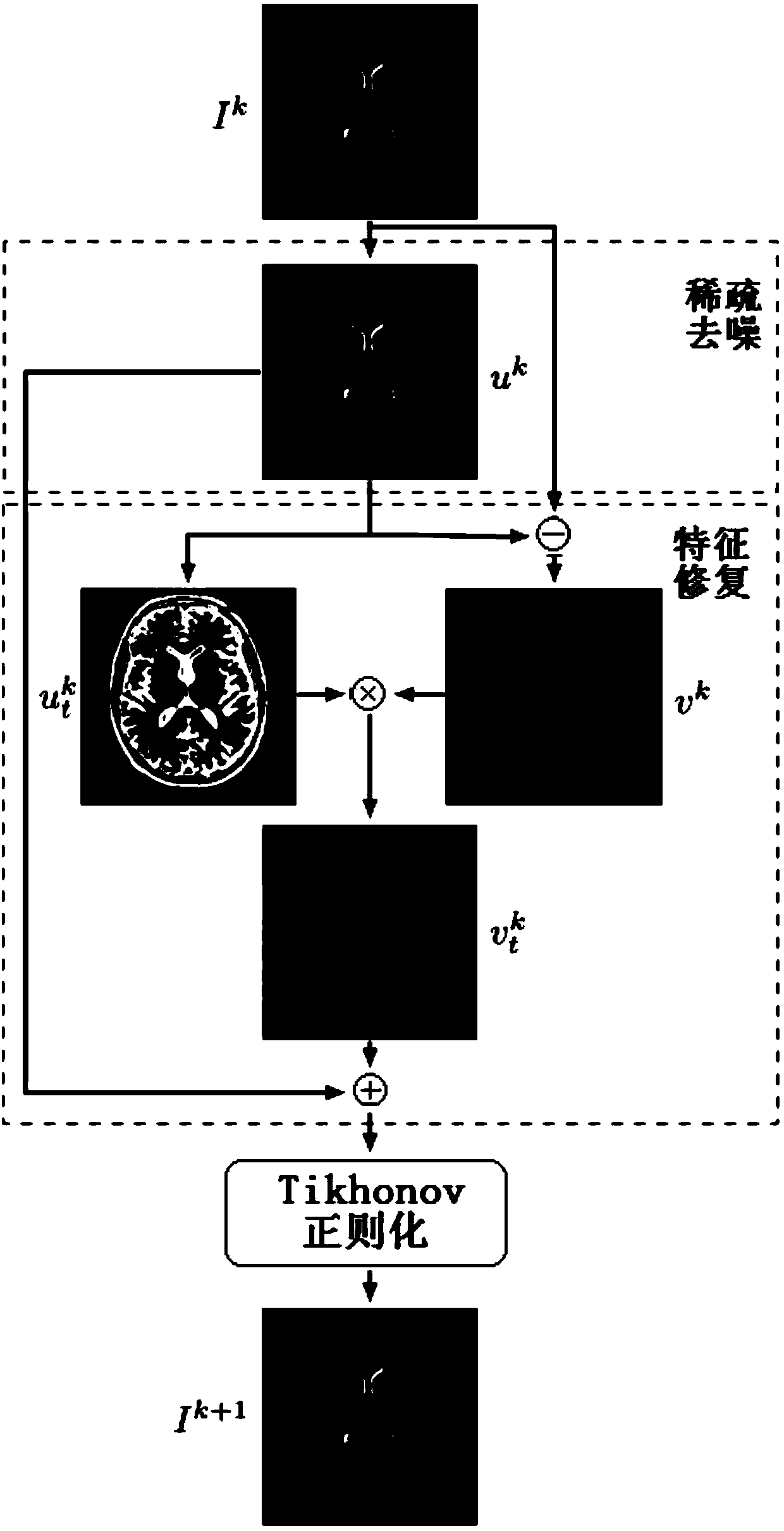 A magnetic-resonance fast imaging method and system based on iterative feature correction