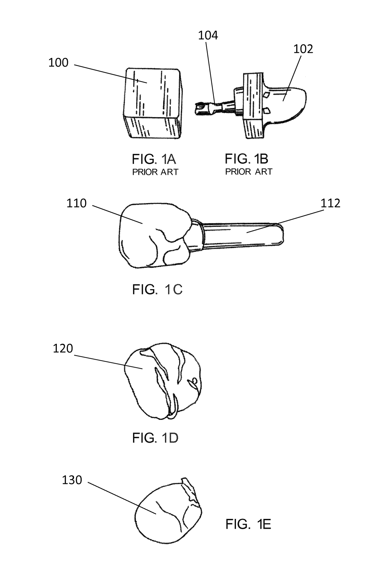 Method and apparatus for preparing a ceramic dental restoration in one appointment