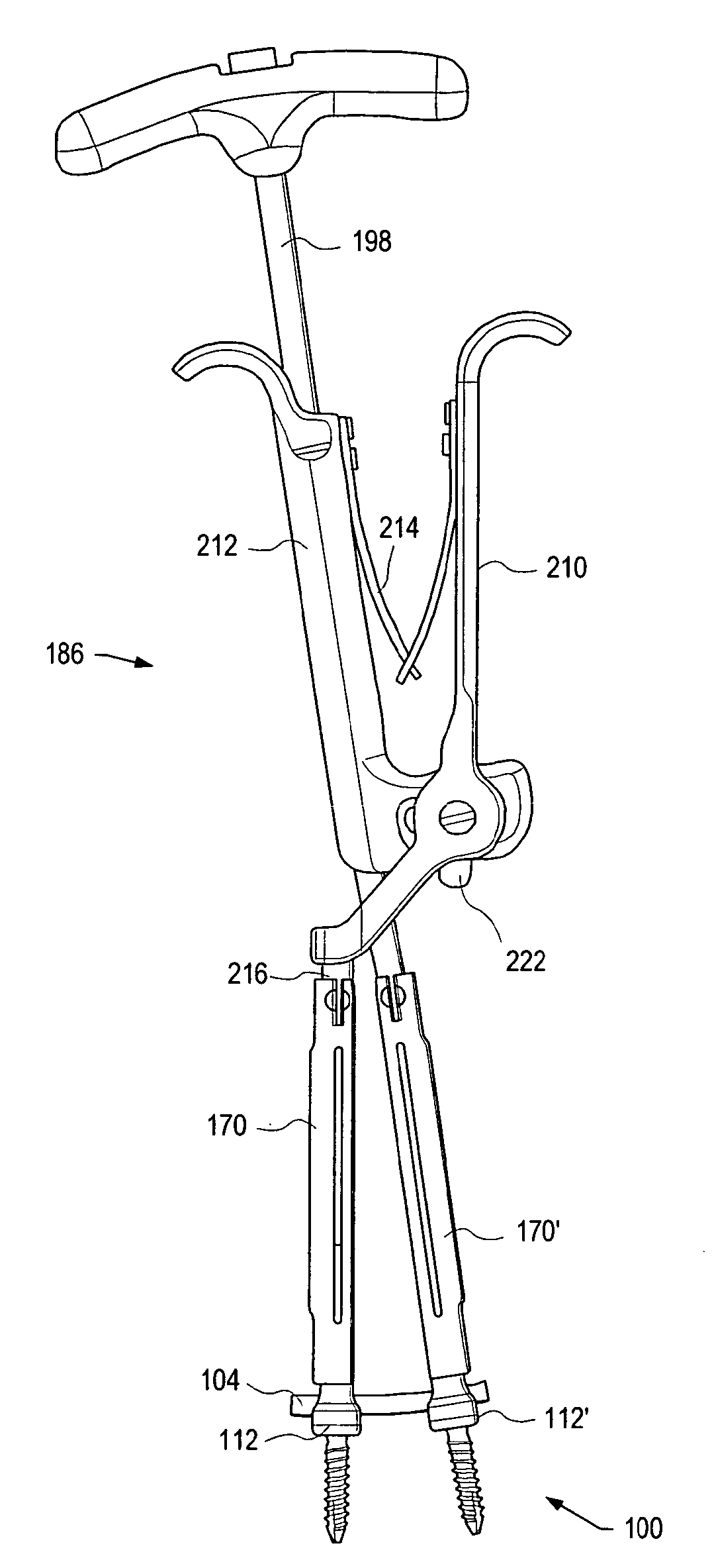 Instruments and methods for adjusting separation distance of vertebral bodies with a minimally invasive spinal stabilization procedure