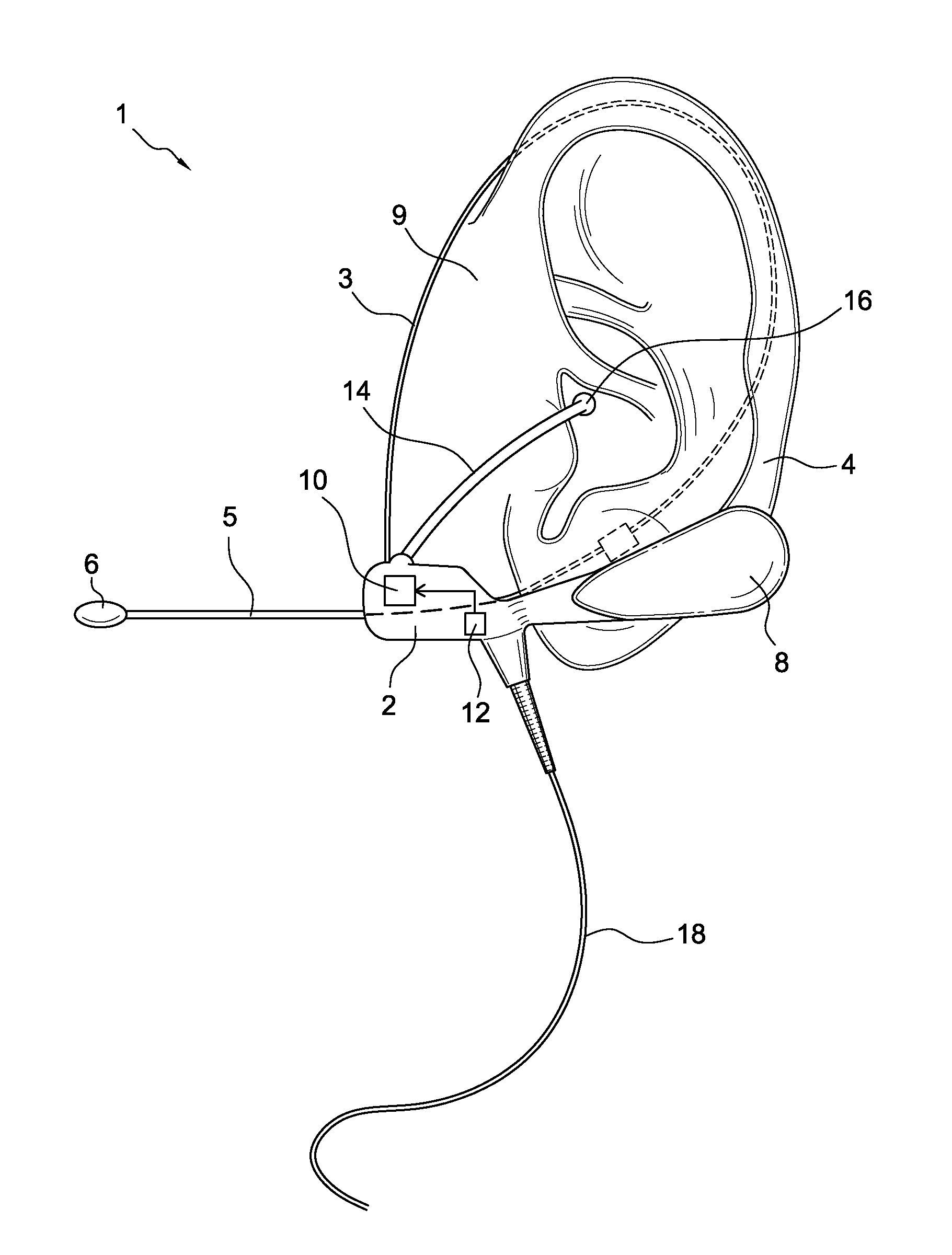 Headset for fitting of an earpiece