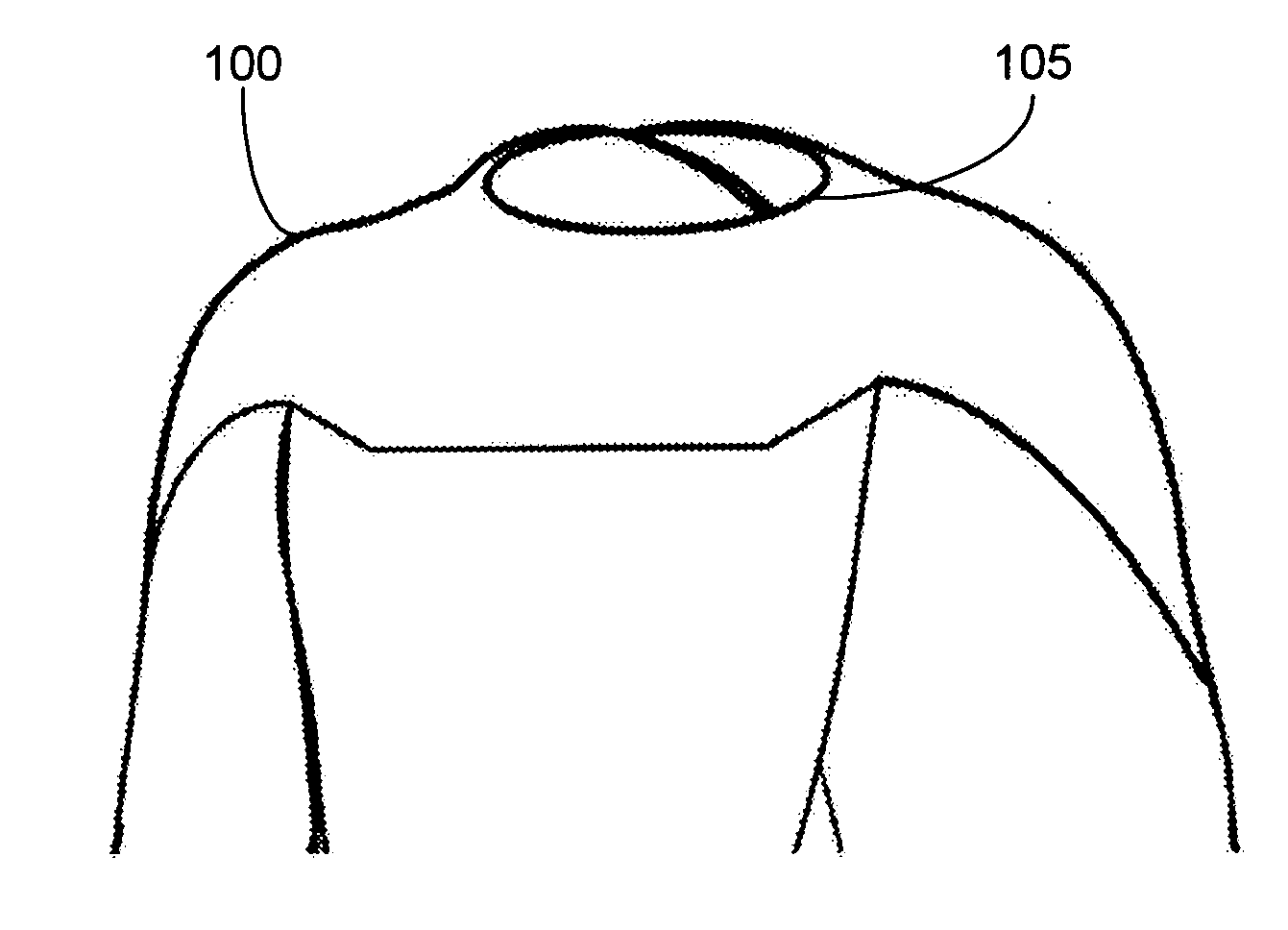 Neck closure system for a wetsuit