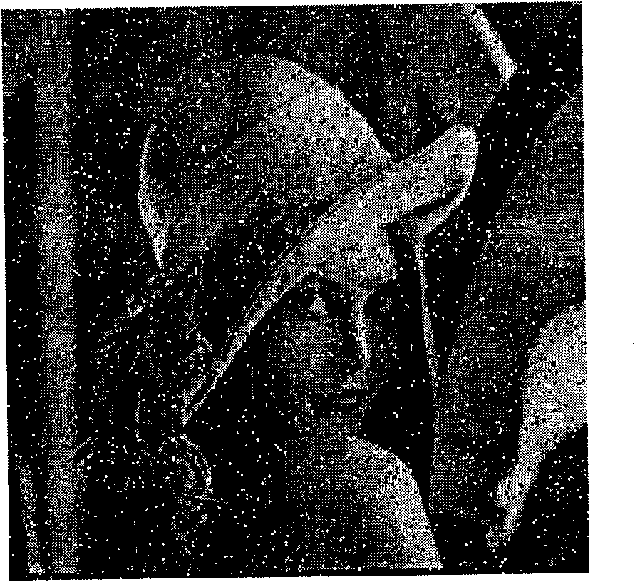 Method for eliminating image impulse noise based on differential image detection and filtration by multiple windows