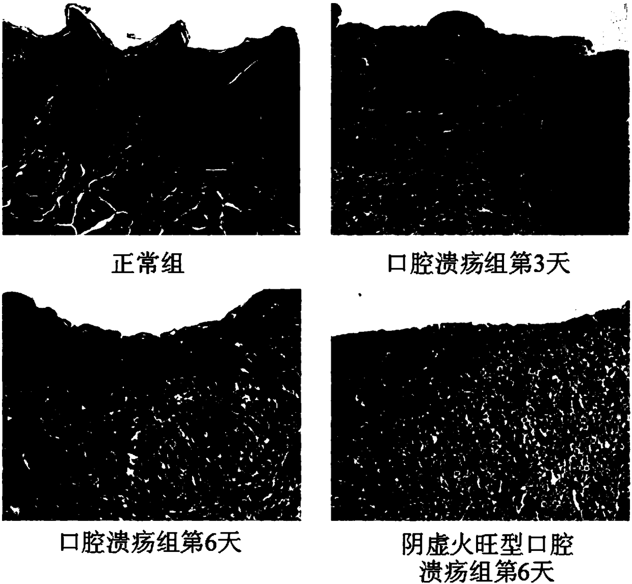 Method for constructing yin-deficiency fire-excess type oral ulcer animal model based on sleep deprivation