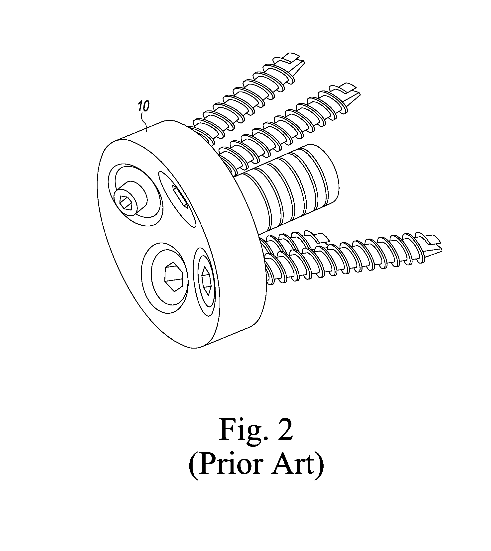 Bone graft shaper for reverse glenoid