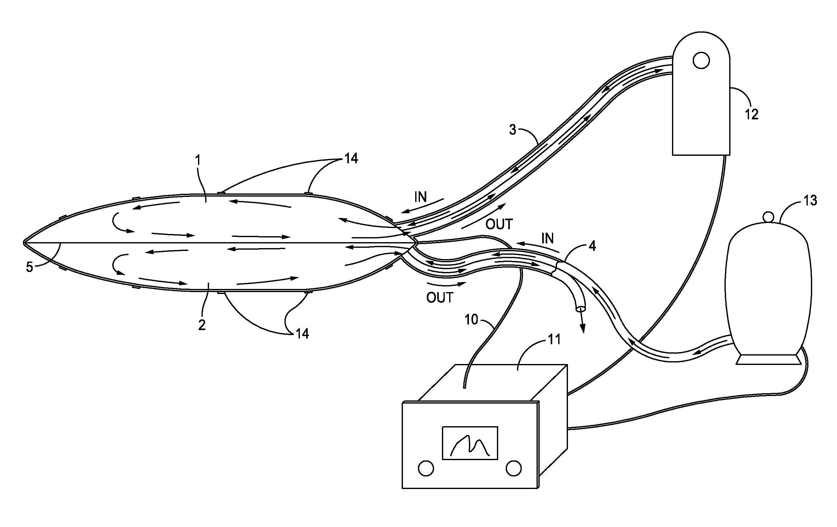 Action/counteraction superimposed double chamber broad area tissue ablation device