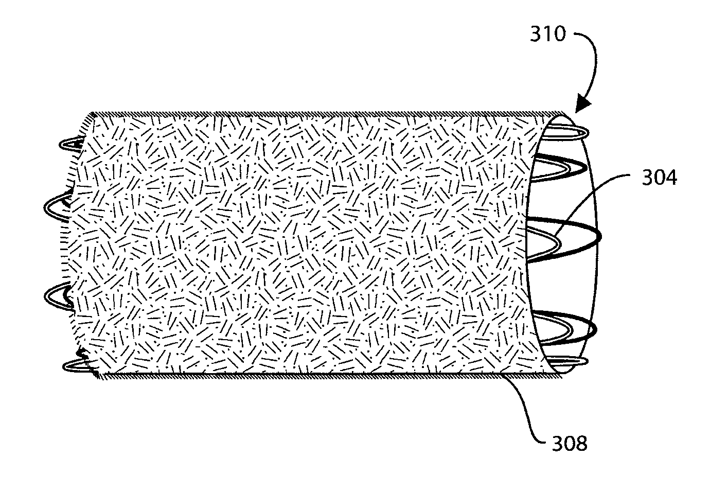 Catheter Delivered Valve Having a Barrier to Provide an Enhanced Seal
