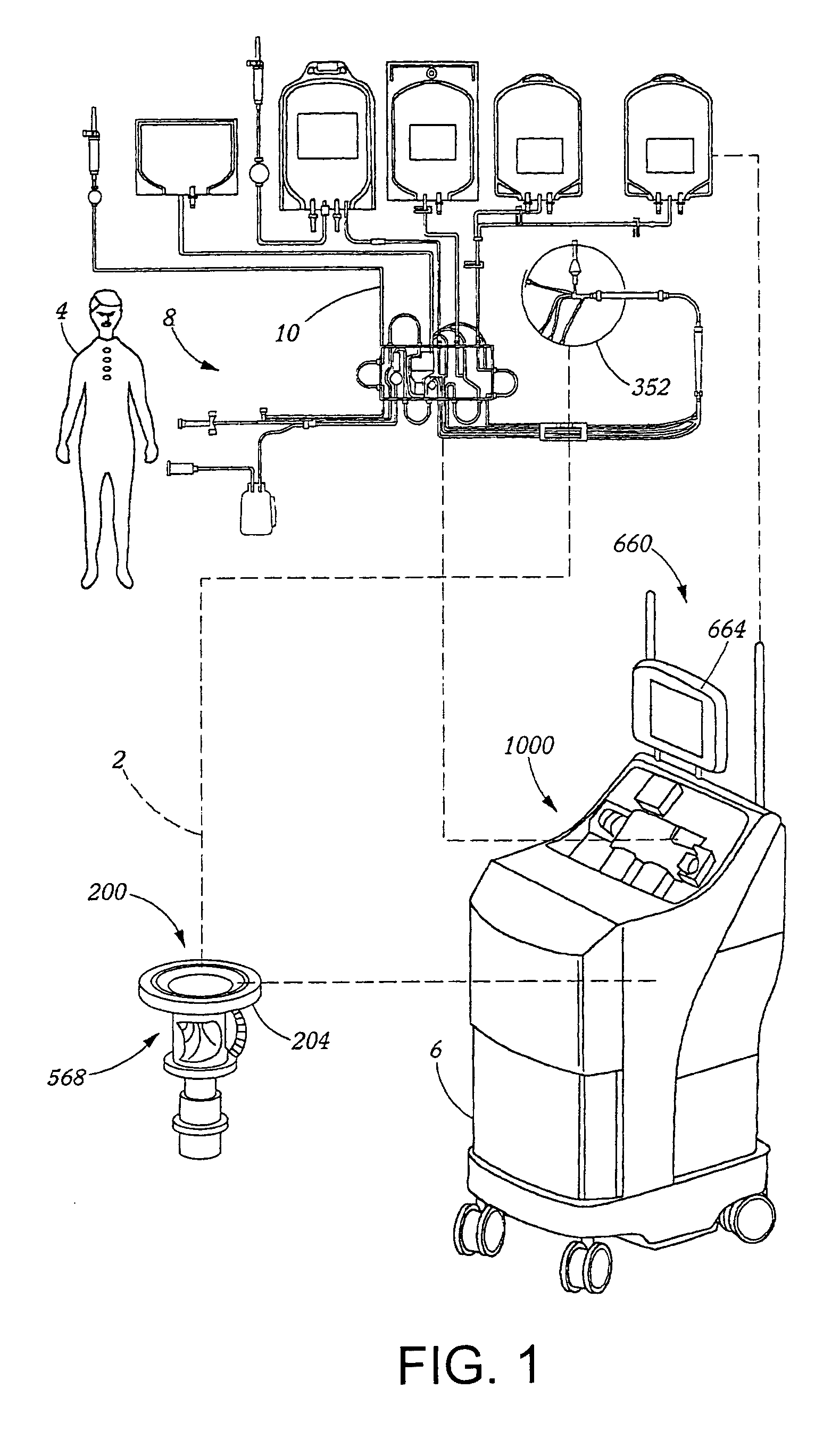 Extracorporeal blood processing methods and apparatus
