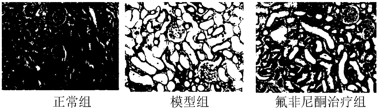 Application of fluorofenedione in preparing drug for treating acute kidney injury