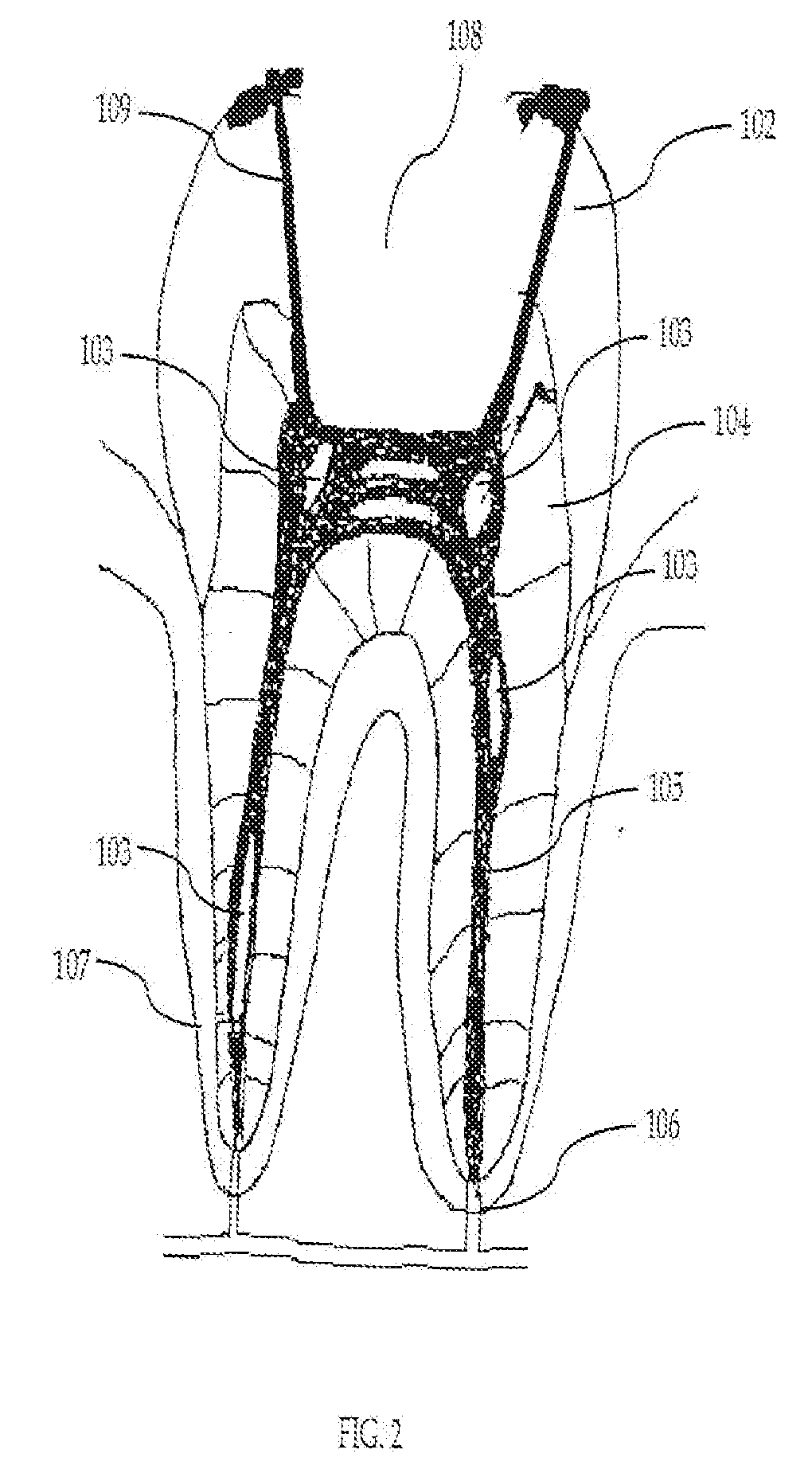 Composition and Method for Using Medicament for Endodontic Irrigation, Stem Cell Preparation and Tissue Regeneration