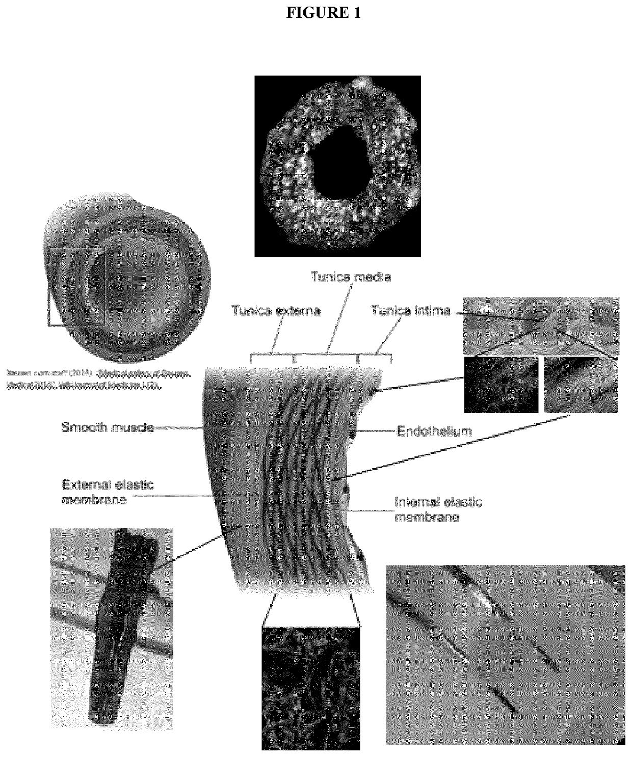 Composite biomaterials