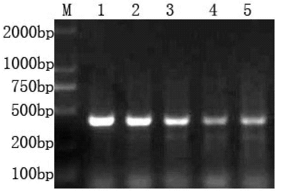 Hybridoma cell strain and monoclonal antibody of anti-heart-type fatty acid-binding protein generated by same