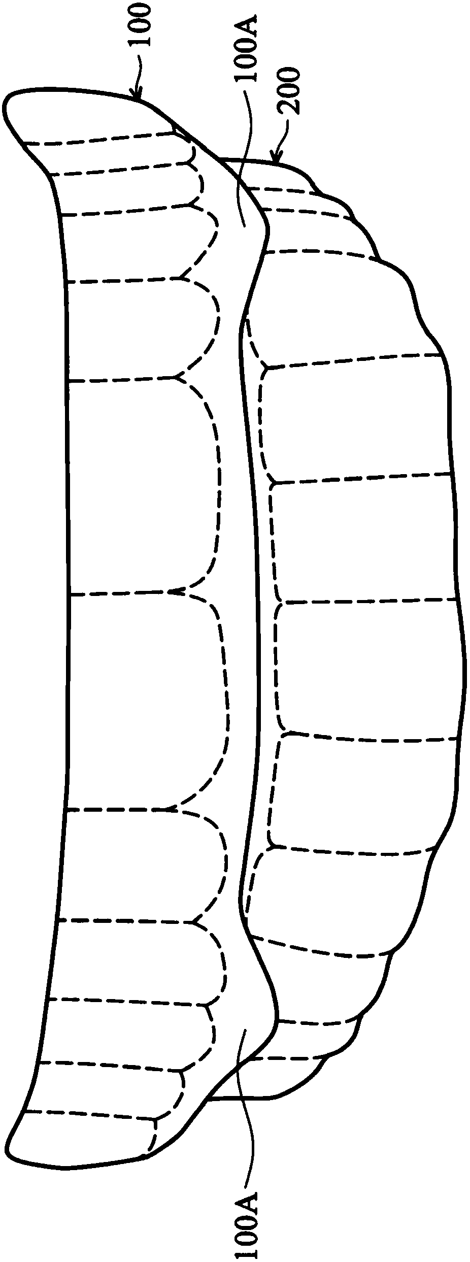 Masticatory orthodontic device and shape memory mesh