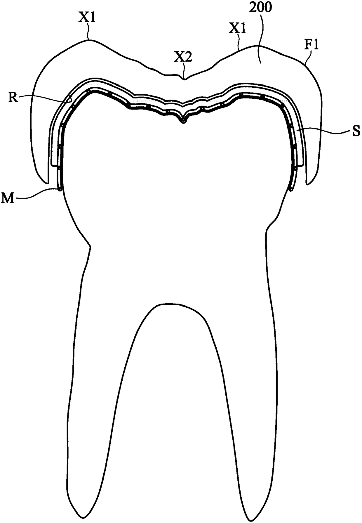 Masticatory orthodontic device and shape memory mesh