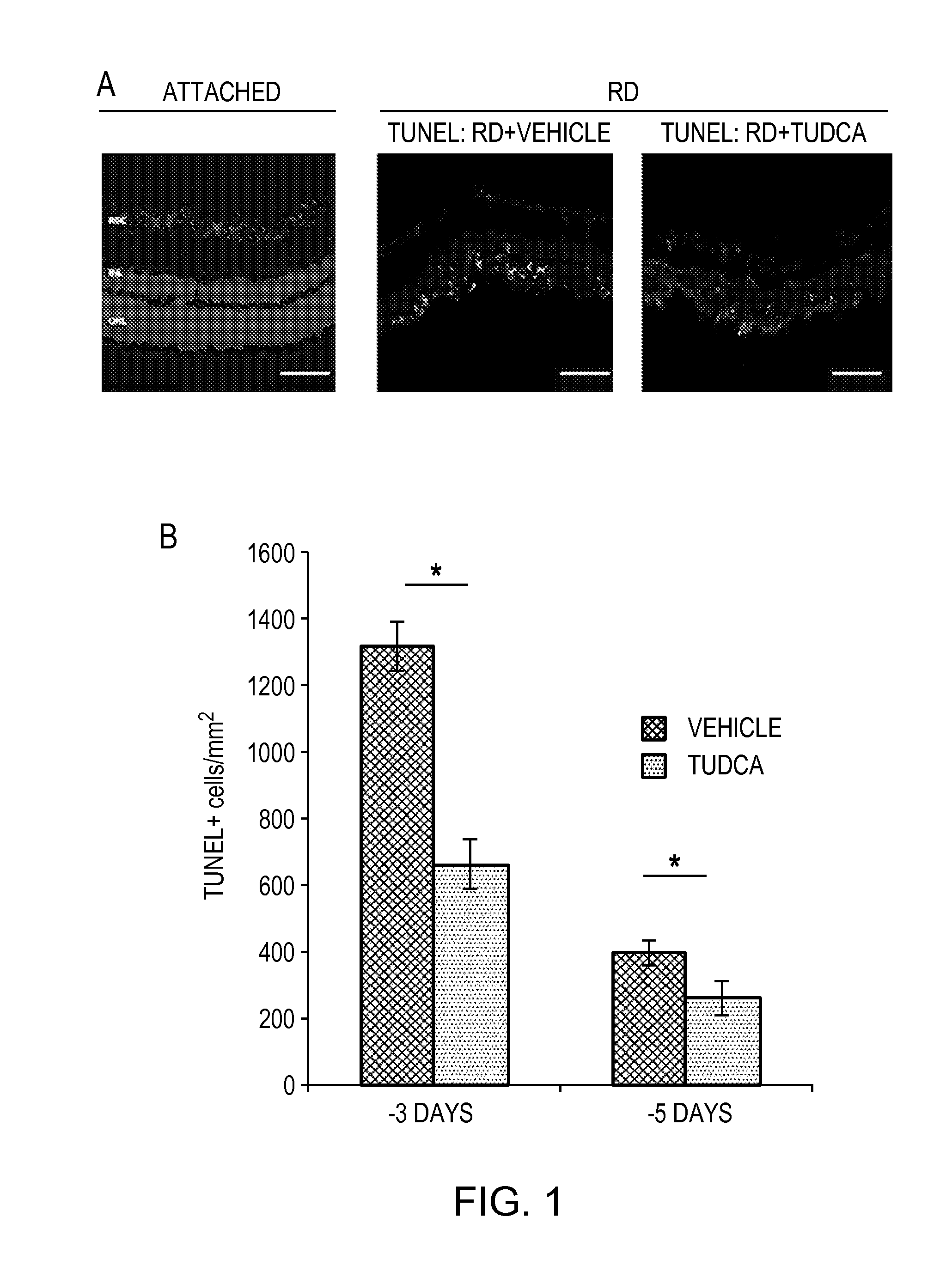 Methods for preserving photoreceptor cell viability following retinal detachment