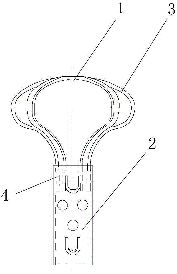 Modeling method of necrosis caput femoris restoring model based on umbrella-shaped caput femoris supporter