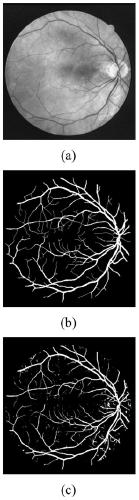 Fundus image blood vessel segmentation method based on full convolutional neural network multi-scale features