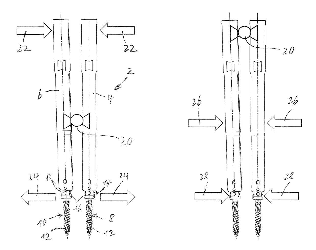 Device for carrying out a distraction or a compression of vertebral bodies during spinal surgery