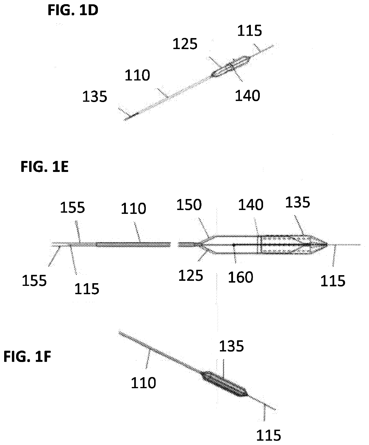 An apparatus and a method for clot and plaque retracting