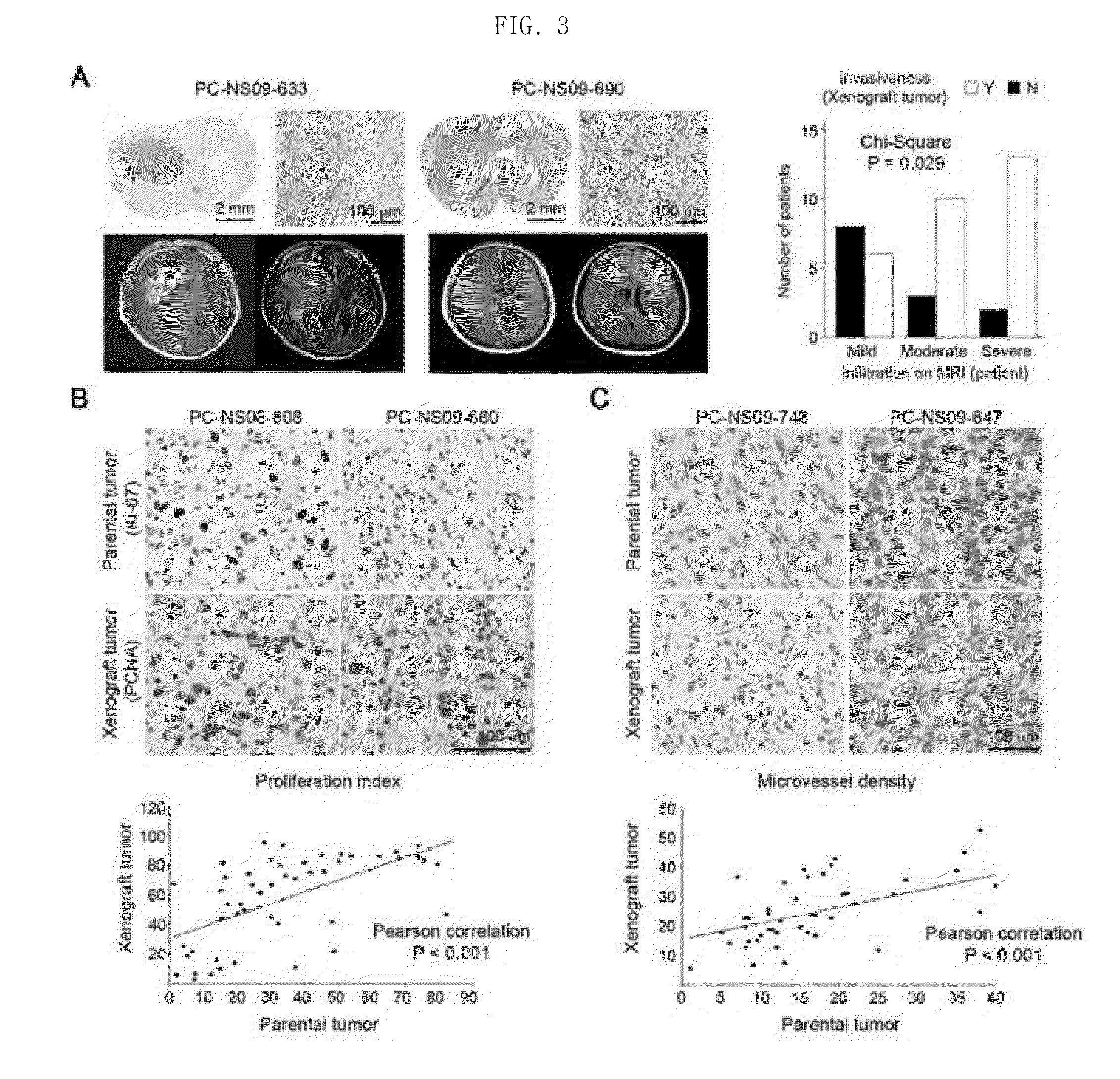Method for preparing patient-specific glioblastoma animal model, and uses thereof
