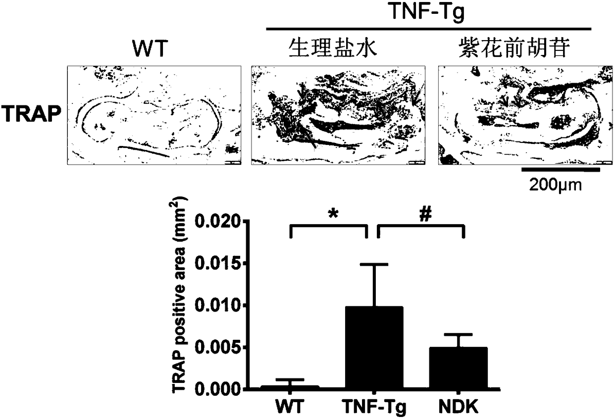 Small-molecule compound for treating rheumatoid arthritis and application thereof