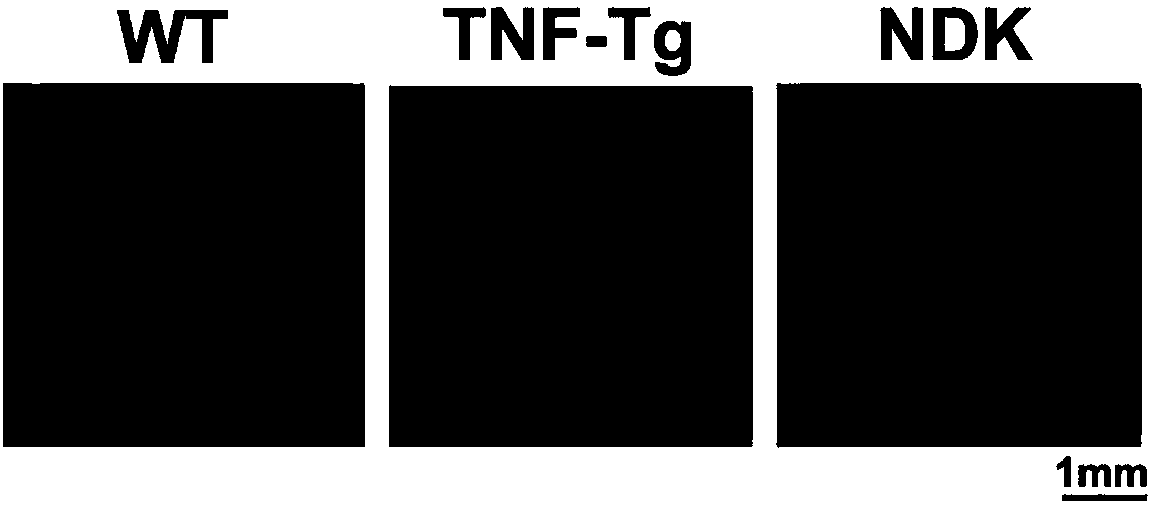 Small-molecule compound for treating rheumatoid arthritis and application thereof