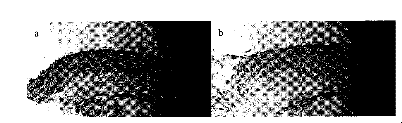 Preparation for promoting fibroblasts to secrete extracellular matrix components and preparation method thereof