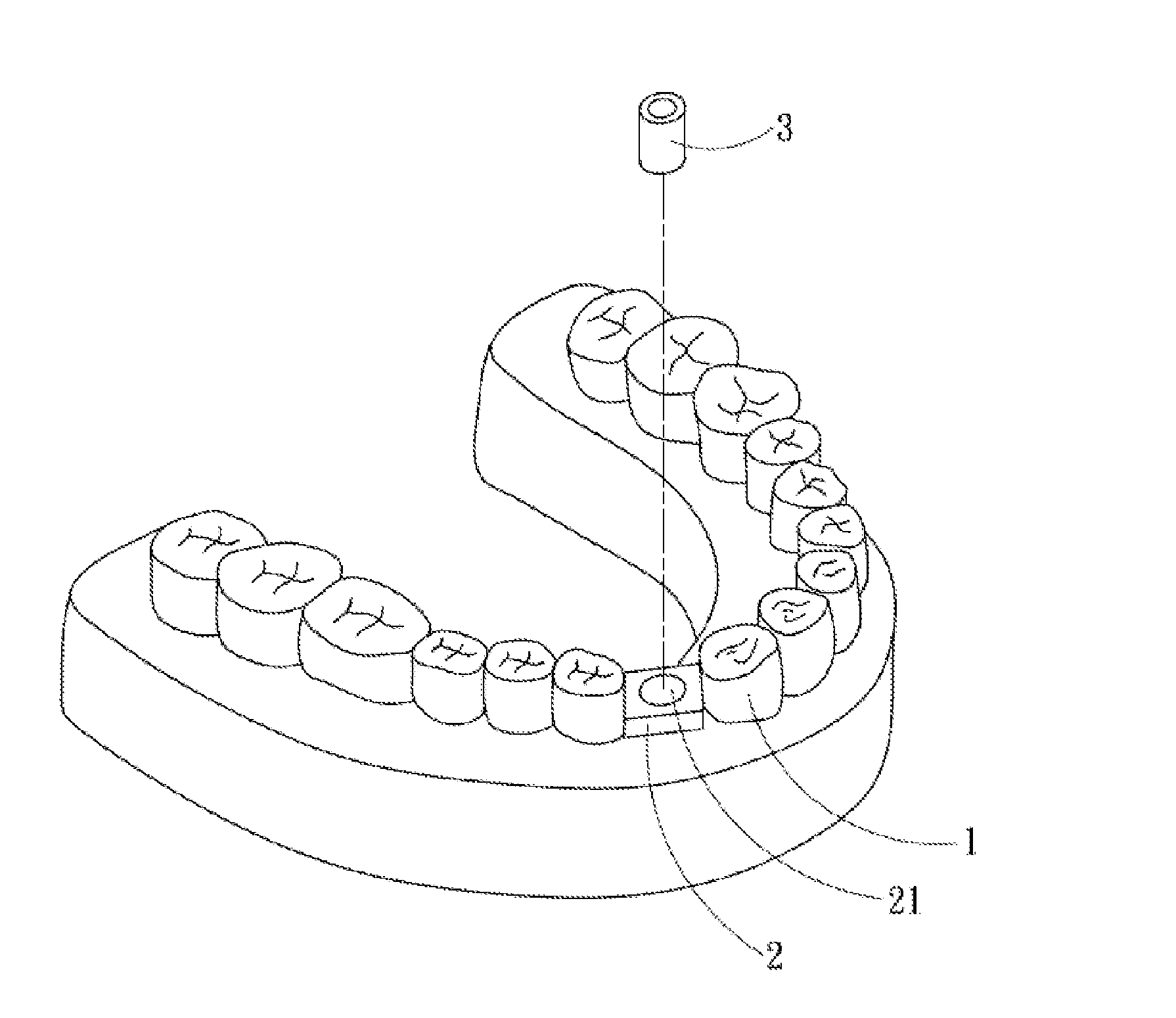 Dental positioning stent, and manufacturing method, using method and components for the same