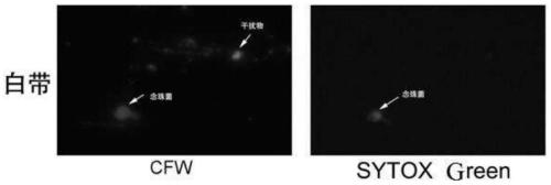 Fungal detection kit and application thereof